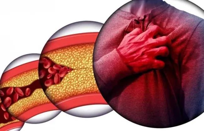 مكون بسيط على أد الإيد يخفض الكوليسترول ويضبط سكر الدم