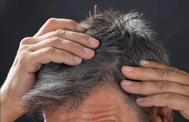 لماذا يظهر الشيب لدى الشباب في سن مبكرة؟